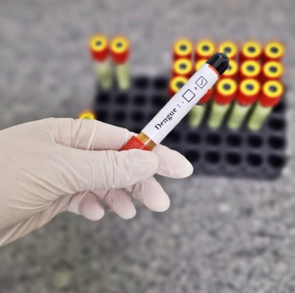 eXAME DA DENGUE