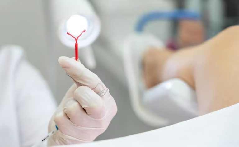 Saúde realiza mutirão de DIU para ampliar acesso ao planejamento reprodutivo